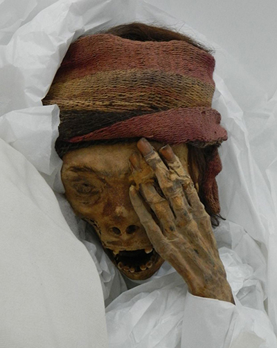 The largest study of mummies ever reported finds widespread evidence of heart disease in ancient mummies around the world
